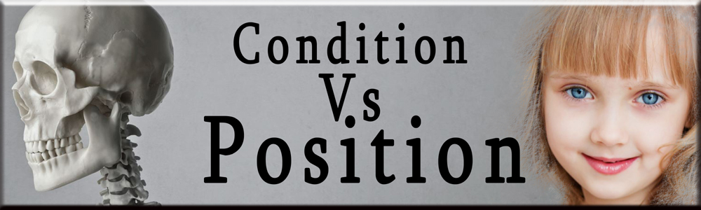 Condition Vs Position